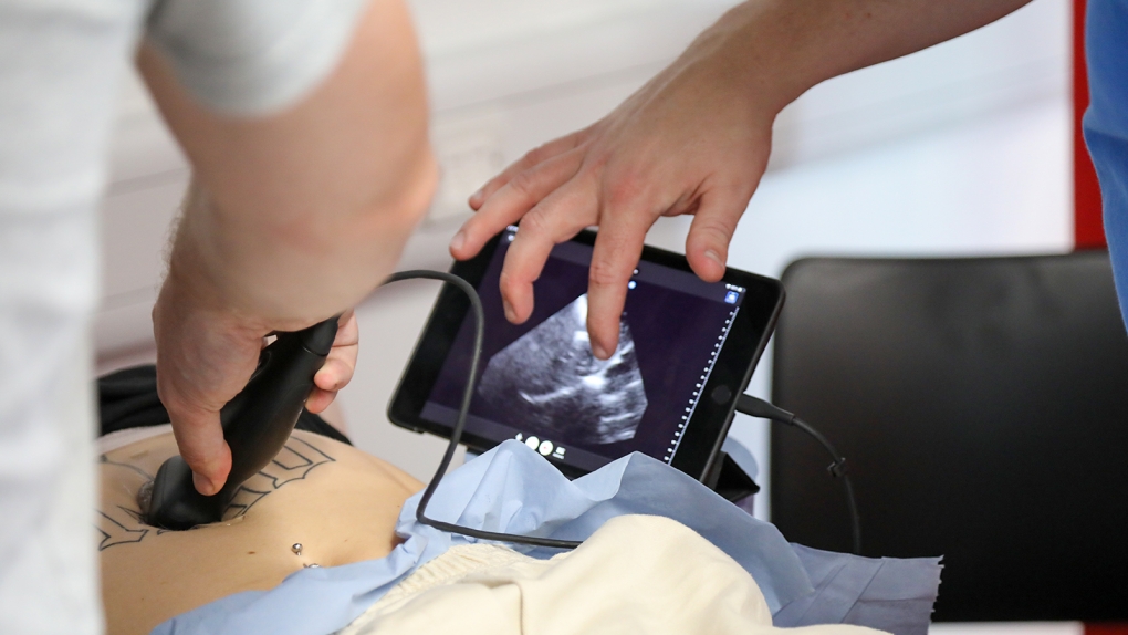 POCUS ultrasound scan